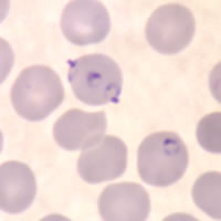 P. falciparum rings - applique form - thin smear