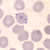 Rings of P. falciparum in a thin blood smear