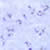 Rings of P. falciparum in a thick blood smear