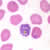 Schizont of P. falciparum in a thin blood smear