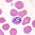 Schizont of P. falciparum in a thin blood smear
