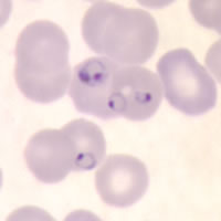 P. falciparum trophozoites - thin smear