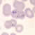 Trophozoites of P. falciparum in a thin blood smear
