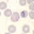 Trophozoites of P. falciparum in a thin blood smear
