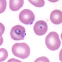P. falciparum trophozoites - thin smear