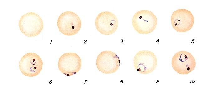 P. falciparum ring stage