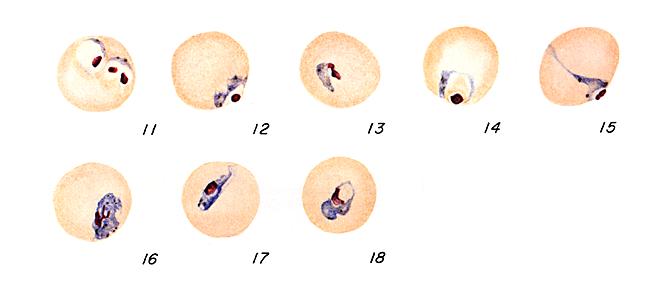 P. falciparum trophozoites