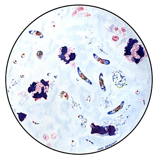 Thick Blood Smears