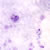 Gametocytes of P. malariae in a thick blood smear