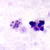Schizonts of P. malariae in a thick blood smear. 