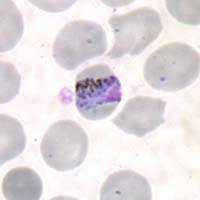 P. malariae trophozoite - thin smear