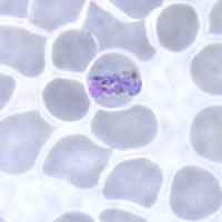 P. malariae trophozoite - thin smear