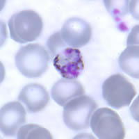 P. malariae trophozoite - thin smear