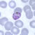 Gametocytes of P. malariae in a thin blood smear