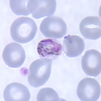 Gametocytes of P. malariae in a thin blood smear