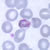 Gametocytes of P. malariae in a thin blood smear