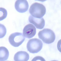 P. malariae ring - thin smear