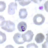 P. malariae ring - thin smear