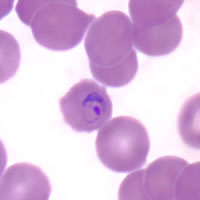 P. malariae ring - thin smear