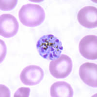 Schizonts of P. malariae in a thin blood smear. 