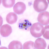 Schizonts of P. malariae in a thin blood smear. 