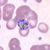 Schizonts of P. malariae in a thin blood smear. 
