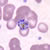 Schizonts of P. malariae in a thin blood smear. 
