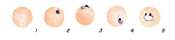 P. malariae ring stage