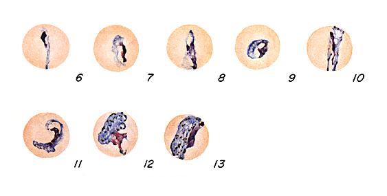 P. malariae trophozoites
