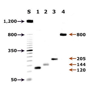 Agarose gel - PCR for malaria