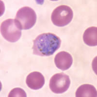 P. ovale gametocytes in a thin blood smear