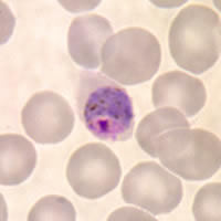 P. ovale gametocytes in a thin blood smear