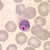 P. ovale gametocytes in a thin blood smear