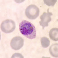 P. ovale gametocytes in a thin blood smear