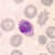 P. ovale gametocytes in a thin blood smear
