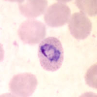 P. ovale ring - thin smear