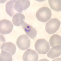 P. ovale ring - thin smear