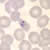 P. ovale rings in a thin blood smear