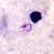 Rings of P. ovale in a thick smear