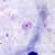 Rings of P. ovale in a thick smear