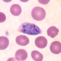 P. ovale schizont - thin smear