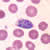 Schizonts of P. ovale in a thin blood smear