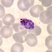 P. ovale schizont - thin smear