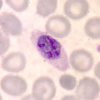 P. ovale schizont - thin smear