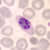 Schizonts of P. ovale in a thin blood smear