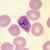 Trophozoites of P. ovale in a thin blood smear
