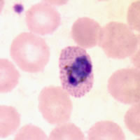 P. ovale trophozoite - thin smear