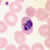 Trophozoites of P. ovale in a thin blood smear