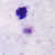 Trophozoite in a thick blood smear