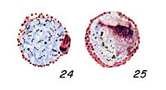 P. ovale gametocytes